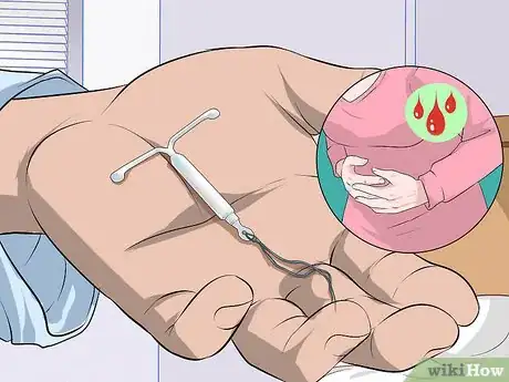 Image titled Identify Signs of Secondary Dysmenorrhea Step 9