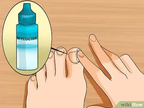 Image titled Get Rid of Yellow Toenails Step 2