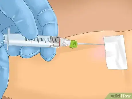 Image titled Treat Multiple Myeloma Step 6