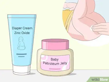 Image titled Treat Diarrhea in Infants Step 8