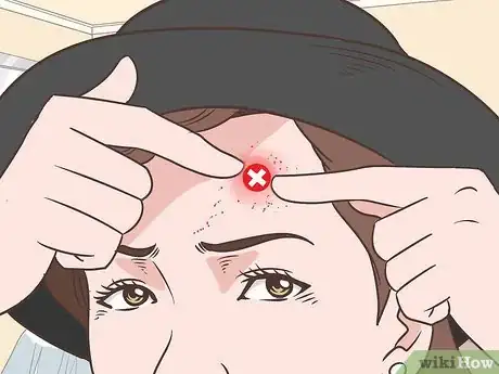 Image titled Relieve Skin Irritated by Face Wash Step 3