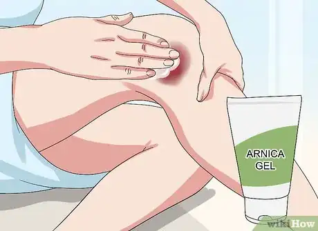 Image titled Heal a Bruise Step 7