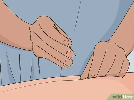 Image titled Heal Fibromyalgia Naturally Step 19