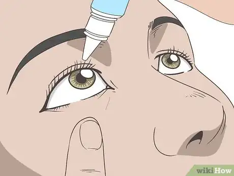 Image titled Manage Eye Disorders with Graves Disease Step 3