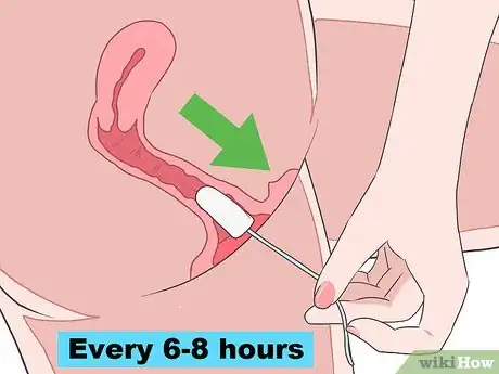 Image titled Insert a Tampon for the First Time Step 14