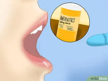 Image titled Prevent Staph Blood Infections Step 6