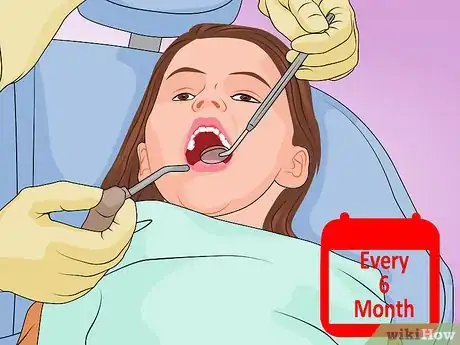 Image titled Protect Your Child's Teeth Step 9