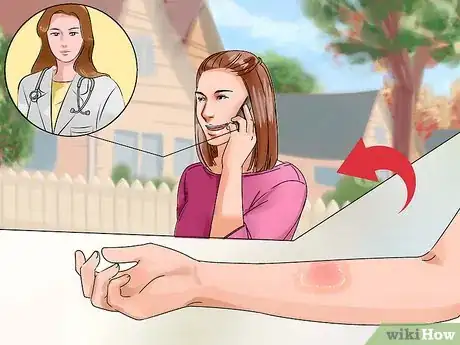 Image titled Avoid Skin Problems at Work Step 18