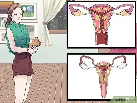 Image titled Treat Vaginal Cysts Step 1