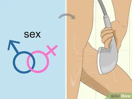 Image titled Avoid UTIs when You're Sexually Active Step 4