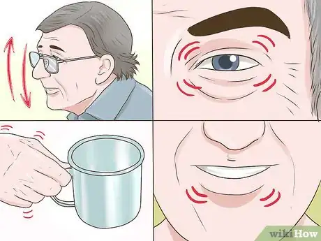 Image titled Diagnose the Cause of Essential Tremor Step 2