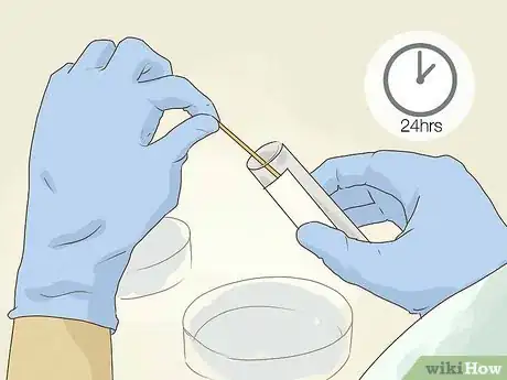 Image titled Test for Tuberculosis Step 13