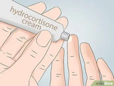 Image titled Cover Inflamed Pimples Step 9