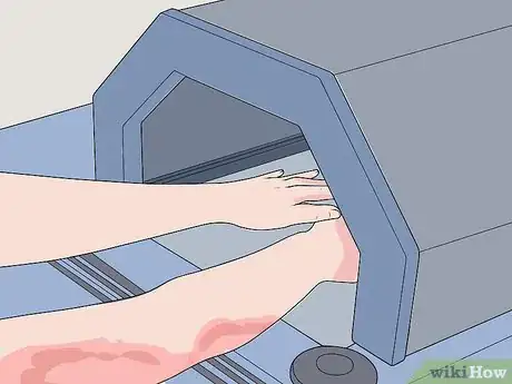 Image titled Treat Psoriasis with Biologics Step 5