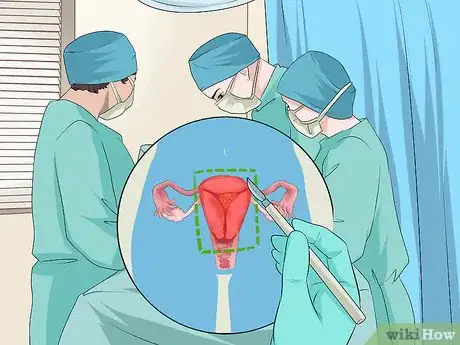 Image titled Treat Ovarian Cancer Step 5