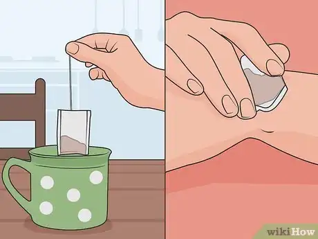 Image titled Use Chamomile As a Fungal Treatment Step 1