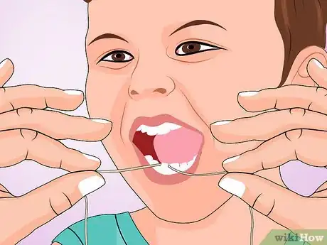 Image titled Protect Your Child's Teeth Step 3