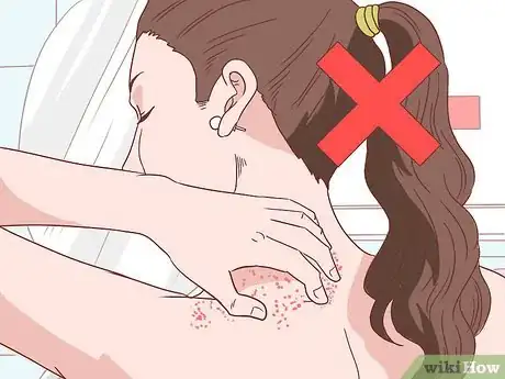 Image titled Handle an Eczema Flare Up Step 27