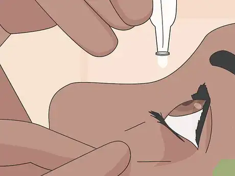 Image titled Deal With Uncomfortable Contact Lenses Step 12