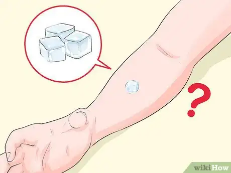 Image titled Do Skin Icing Step 9