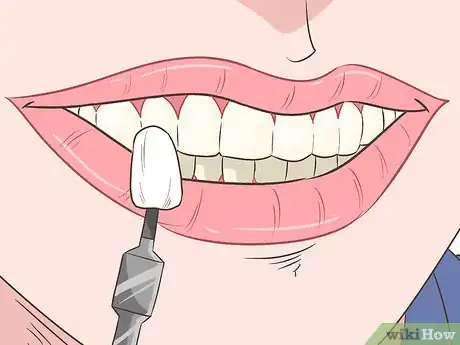Image titled Straighten Your Teeth Without Braces Step 15
