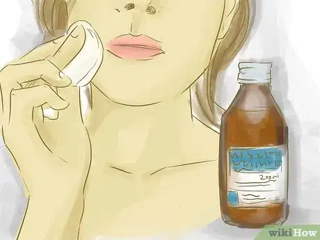 Image titled Get a Clean, Acne Free Face Step 14