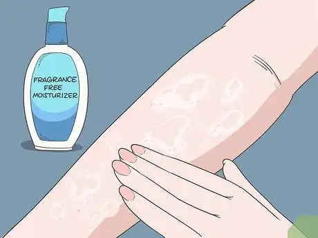 Image titled Stop Scabies Itching Step 3