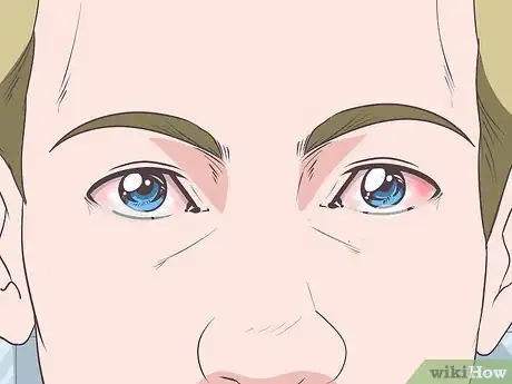 Image titled Recognize the Signs of Graves' Disease Step 11