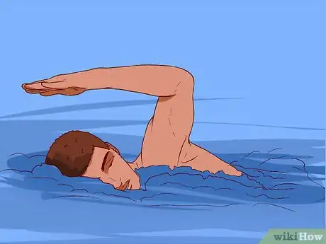 Image titled Treat Juvenile Arthritis Step 10