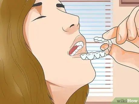 Image titled Get Low Cost Tooth Whitening Step 3