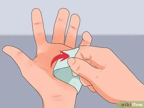 Image titled Remove Fiberglass Slivers from Your Skin Step 5
