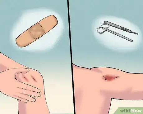 Image titled Use a Band Aid Step 1