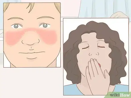 Image titled Handle a Lupus Flare Step 14