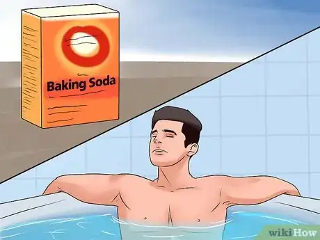 Image titled Treat Winter Eczema Step 6