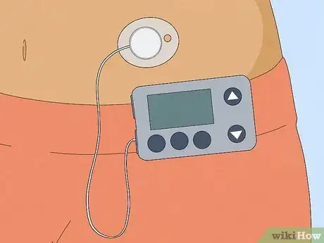 Image titled Prevent Kidney Damage with Type 1 Diabetes Step 10