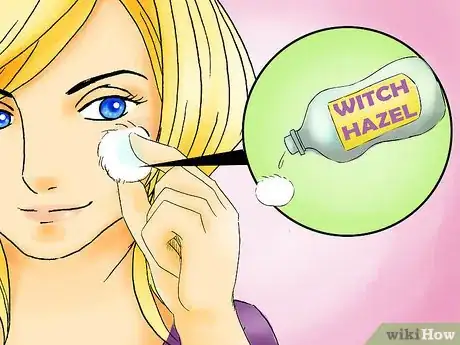 Image titled Prevent Ingrown Facial Hair Step 13