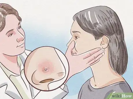 Image titled Treat an Infected Nose Piercing Step 8