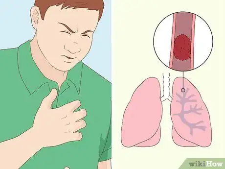 Image titled Diagnose Lung Problems Step 2