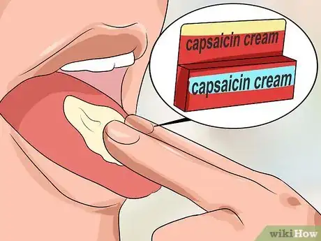 Image titled Heal a Sore Tongue Step 10