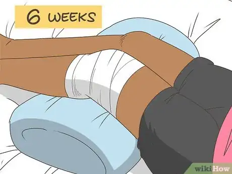 Image titled Repair Knee Ligament Damage Step 14