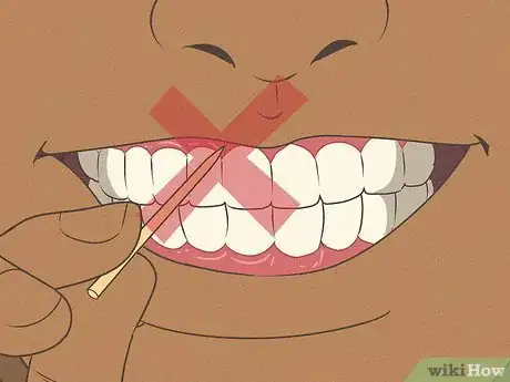 Image titled Avoid Hurting Your Gums Step 4
