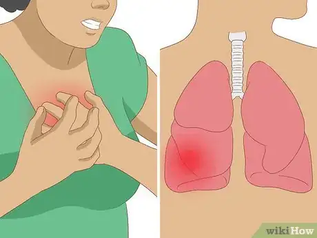 Image titled Prevent and Treat a Thyroid Storm Step 1