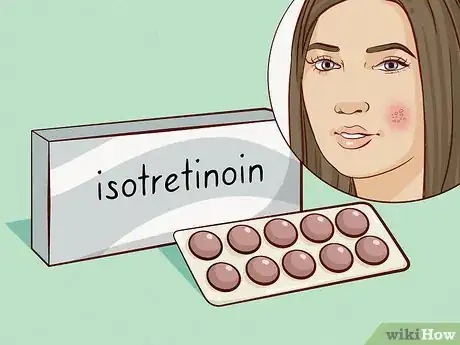 Image titled Reduce Acne Pain Step 9