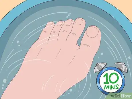 Image titled Trim Toenails with Fungus Step 1