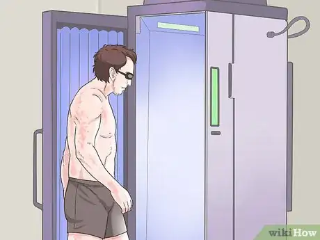 Image titled Soothe Psoriasis Itching Step 11