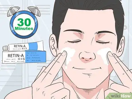 Image titled Avoid Adult Acne Step 3