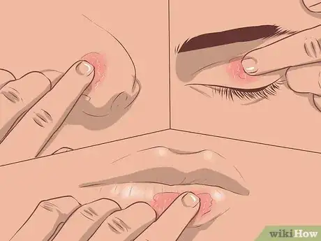 Image titled Use Cayenne for Back Pain Step 10