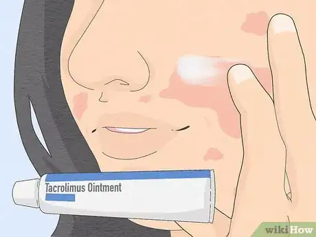 Image titled Wear Makeup when You Have Eczema Step 20