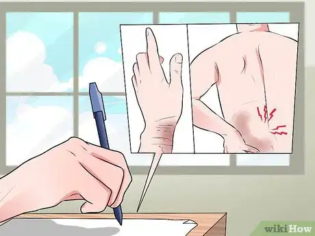 Image titled Get Compensation from a Bui Accident Step 9