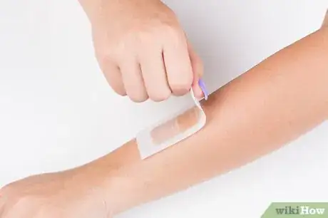 Image titled Remove Hair from the Arms Step 16